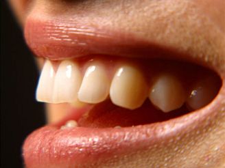 Zažloutlé zuby nevypovídají vždy jen o špatné zubní hygieně.