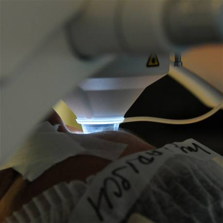 laser 1