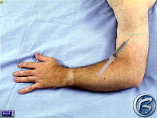 Code Blue