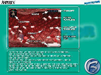 Aspirin Protector