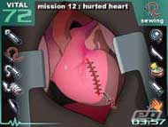 Caduceus Surgical Operation